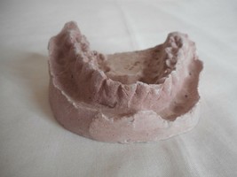 Vintage Cast Dental Teeth Mold  Tooth Castings Medical Oddity #9 - $282.72 MXN