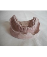 Vintage Cast Dental Teeth Mold  Tooth Castings Medical Oddity #9 - $282.72 MXN