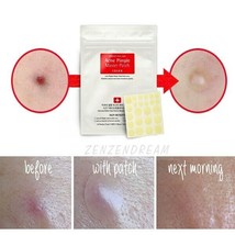 NEW COSRX Acne Pimple Master Patch  6 sheets X 24 Patches Reduce Acne Spots - $18.81