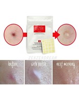 NEW COSRX Acne Pimple Master Patch  6 sheets X 24 Patches Reduce Acne Spots - $19.94