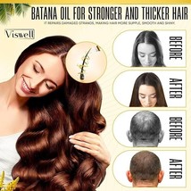 Batana Oil Hair Growth - 5 fl oz,%100 Pure, Natural &amp; Organic Prevents Hair Loss - £18.27 GBP