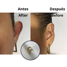 Big ears corrector - $53.00