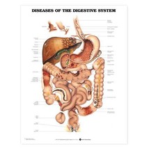 Digestive System Diseases Anatomical Chart - £17.06 GBP