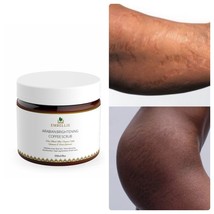 Coffee Exfoliating Body Scrub For Stretch Mark, Cellulite, Acne - £13.89 GBP