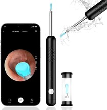Ear Wax Removal Tool, Smart Ear Cleaner, Ear Camera Scope with Light - £17.77 GBP
