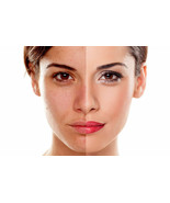 Hyaluronic Acid Serum Wrinkle HA Matrixyl 3000 Vitamin C Anti Aging Plum... - $16.95+