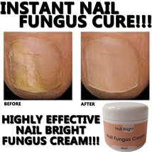 Nail Bright Nail Fungus Cream Healthy Strong Manicured Nails Works Fast ! - £20.29 GBP