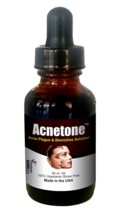 Acnetone-Vitalee Anti Akne Entzündung &amp; Makel Nicht Klebend Öl (30 /60 ML) - £51.58 GBP