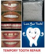 Dental Tooth Repair Granules Temporary Fitting Beads Reusable Faase Teeth - £10.93 GBP