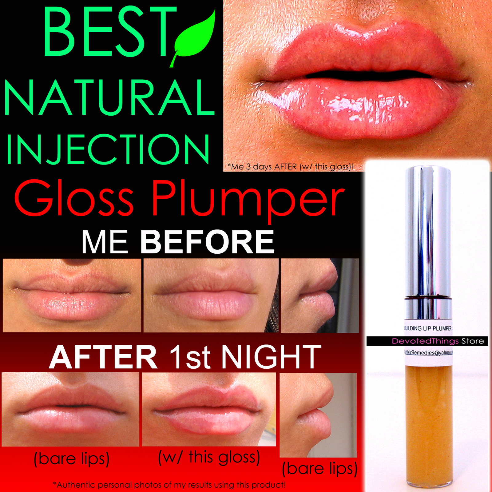 NATURAL INJECTION LIP PLUMPING GLOSS EXTREME REBUILDING LIP PLUMPER THAT WORKS  - $47.99