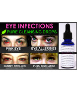 Natural Eye Drops for Pink Eye and Eye Infections for Healthy Bright Eyes - £25.85 GBP