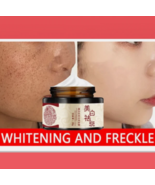 Whitening Cream for Freckles &amp; Dark Spots Face Moisturizer - $22.95