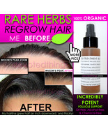 BEST ORGANIC Hair Loss Treatment and Hair Growth Support Anti Dandruff S... - £35.65 GBP