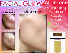 Facial Glow Daily Cleanser Scrub &amp; Mask For Acne Scars &amp; Dark Spots Face Bleachi - £32.16 GBP