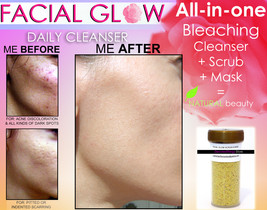 Facial Glow Daily Cleanser Scrub &amp; Mask For Acne Scars &amp; Dark Spots Face Bleachi - £31.45 GBP