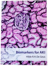 BIOMARKERS FOR AKI Acute Kidney Injury HILDE R.H. DE GEUS Paperback PhD ... - £35.16 GBP