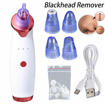 Electric Cleaner Face Blackhead Remover Diamond Pore Vacuum Suction Head... - £12.50 GBP