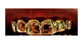 14k gold Overlay Removable gold teeth caps Grillz & mold kit 6 teeth grills bott - £83.95 GBP