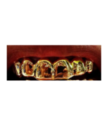 14k gold Overlay Removable gold teeth caps Grillz &amp; mold kit 6 teeth gri... - £82.13 GBP