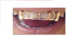 14k gold Overlay Removable gold teeth caps Grillz &amp; mold kit 6 teeth gri... - £83.62 GBP