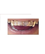 14k gold Overlay Removable gold teeth caps Grillz & mold kit 6 teeth grills bott - $105.00