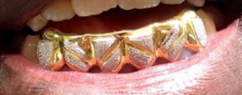 14k gold Overlay Removable gold teeth caps Grillz & mold kit 6 teeth grills bott - £82.56 GBP