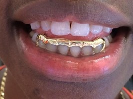 14k gold Overlay Removable gold teeth caps Grillz - £82.59 GBP
