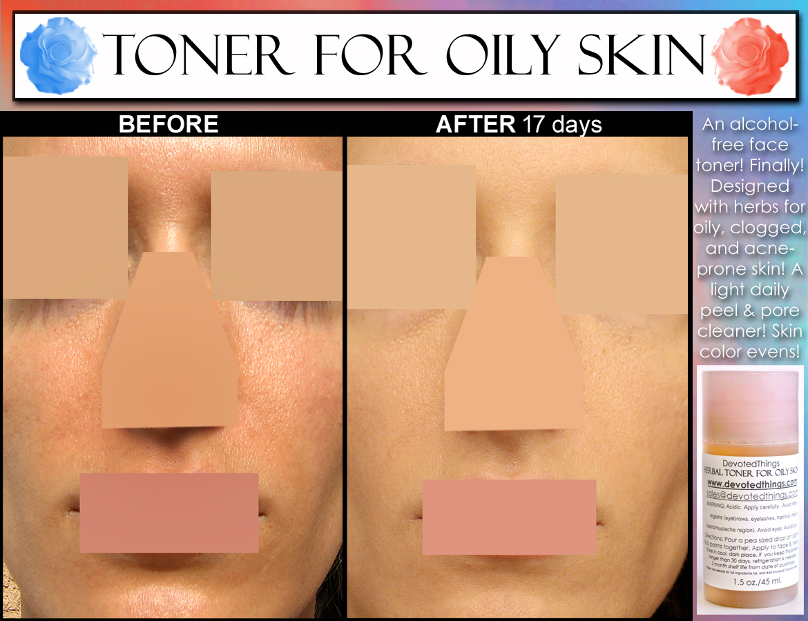 ALCOHOL FREE HERBAL Toner For Oily Skin & Acne with Salicylic Acid and Lemon - $31.99
