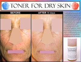 Natural Alcohol Free Toner For Women With Dry, Sensitive, Aging, Or Combo Skin  - £25.63 GBP