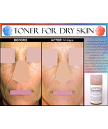 NATURAL ALCOHOL FREE TONER for Women with Dry, Sensitive, Aging, or Comb... - £25.06 GBP