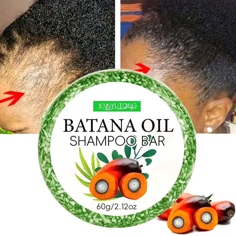 Batana oil shampoo bar thumb200