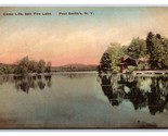 Camp on Spit Fire Lake New York NY UNP Albertype DB Postcard W15 - $5.89