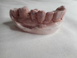 Vintage Cast Dental Teeth Mold  Tooth Castings Medical Oddity #11 - $702.36 MXN