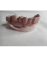 Vintage Cast Dental Teeth Mold  Tooth Castings Medical Oddity #11 - $700.09 MXN