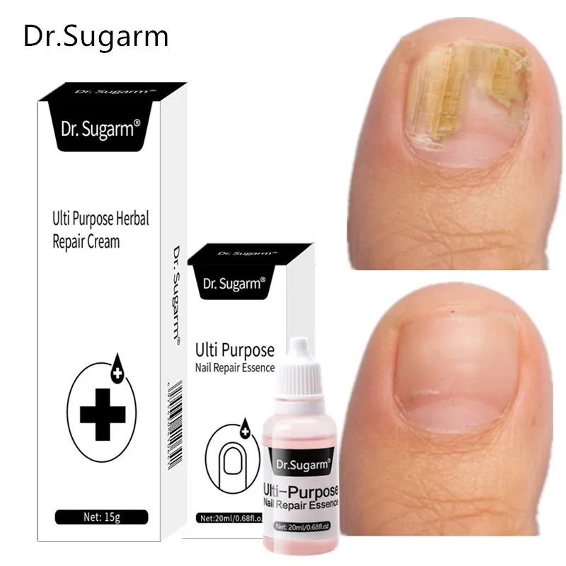 Play Dr.Sugarm Extra Strong Nail Fungal Treatment Feet Care Essence Best Foot Re - £25.48 GBP