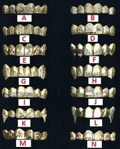14k gold Overlay Removable gold teeth caps Grillz mold kit 6 teeth grill... - $105.00