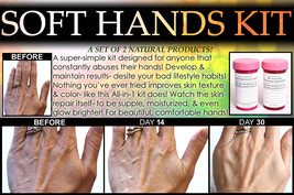Natural Soft Hands Kit Dry Cracked Hands Repair Hand Scrub and Healing O... - £38.31 GBP