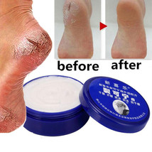 Herbal Crack Foot Repair Feet Cream Oil Anti-Drying Cream Cracked Heel Bad Skin - £6.31 GBP