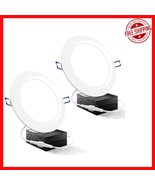 14W LED Recessed Lighting with Junction Box - 850 Lumens, Dimmable, IC R... - $657.97 MXN