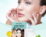 306pcs/Box, Acne Patch Skincare Set, Tea Tree Oil Facial Cleansing Patch - $26.60+