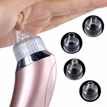 Electric Blackhead Acne Home Pore Clean Exfoliating Instrument Spot Cleaner ! - £39.08 GBP
