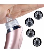 Electric Blackhead Acne Home Pore Clean Exfoliating Instrument Spot Clea... - $67.90 CAD