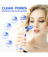 SACOTO Blackhead Remover Pore Vacuum, Face Suction Pore Cleaner - $25.93 CAD