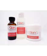 Skin Obsession 25% TCA Peel Kit - $60.99
