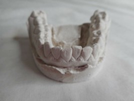 Vintage Cast Dental Teeth Mold  Tooth Castings Medical Oddity #13 - $702.36 MXN