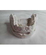 Vintage Cast Dental Teeth Mold  Tooth Castings Medical Oddity #13 - $700.09 MXN