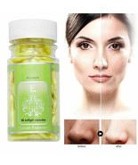 90pcs Vitamin E Essence Capsules Anti-Aging Serum Spot Acne Removing Whi... - £12.89 GBP