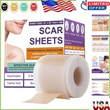 Advanced Silicone Scar Removal Strips - Soft &amp; Breathable 1.5m Custom Size - $26.46 CAD