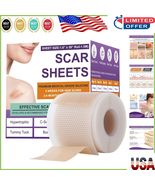 Advanced Silicone Scar Removal Strips - Soft &amp; Breathable 1.5m Custom Size - $350.07 MXN