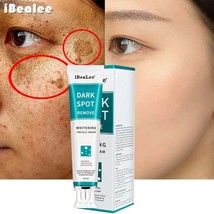 iBeaLee Whitening Freckle Cream Remove Melasma Cream Remove Dark Spots Melanin M - £6.84 GBP+
